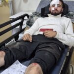 Ömer Faruk Aygören Kozan Devlet Hastanesinde tedavi altına alındı